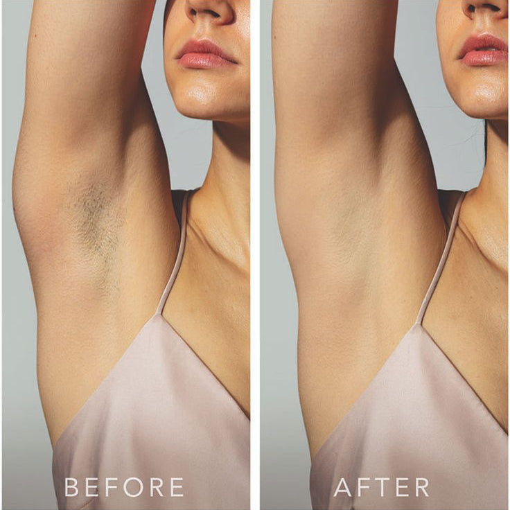 Intimate Brightening Cream
